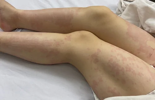 vua-xuong-may-bay-nguoi-phu-nu-phai-nhap-vien-khan-856