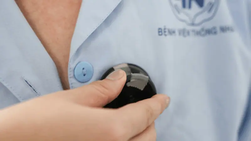 Benh nhan mac lupus ban do he thong can tuan thu dung lieu trinh dieu tri 2